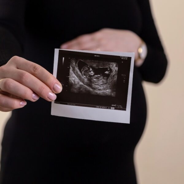 Picture of a pregnant woman with a scan picture after seeing a fertility specialist like Dr Nicole Hope